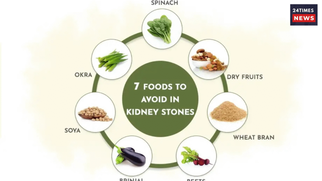 kidney stone 3 kidney stone 3