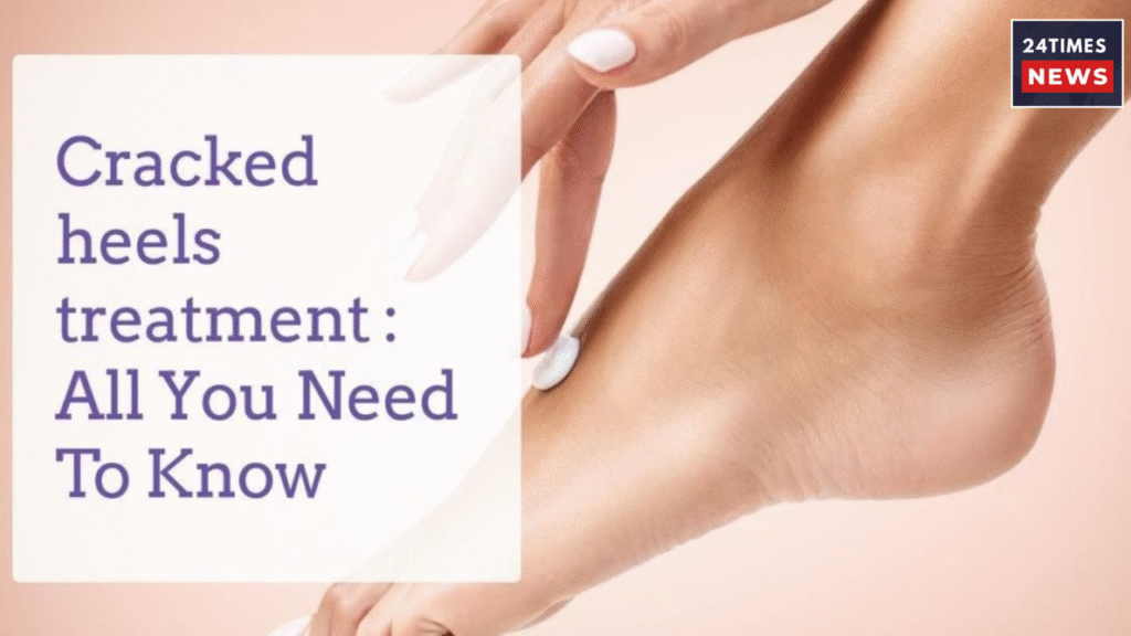 Untitled design 2025 12 23T214551.408 Cracked Heels home remedies