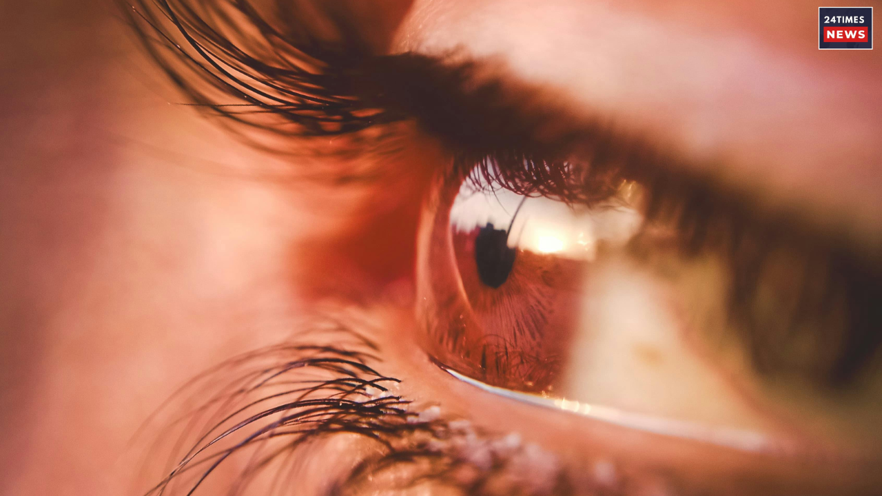 eyelashes 1