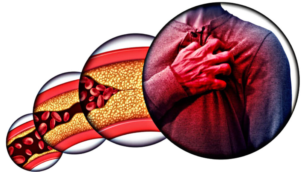 A0811DC6 E6FB 4FD8 8479 975E6D5698A0