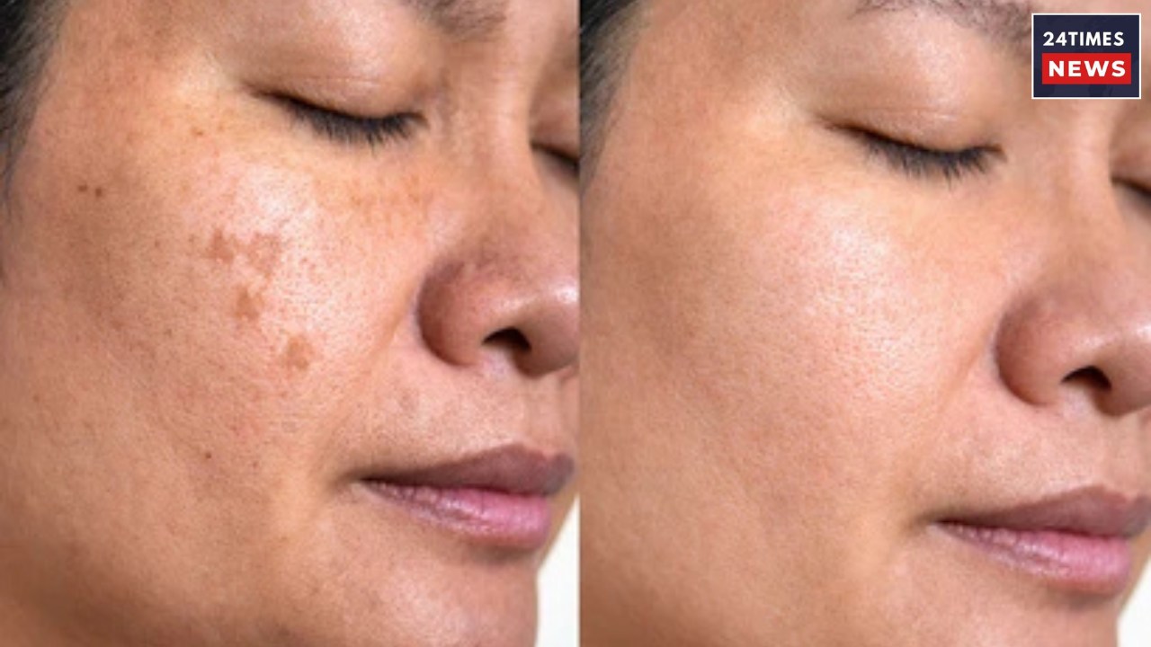 Untitled design 2026 01 19T092135.360