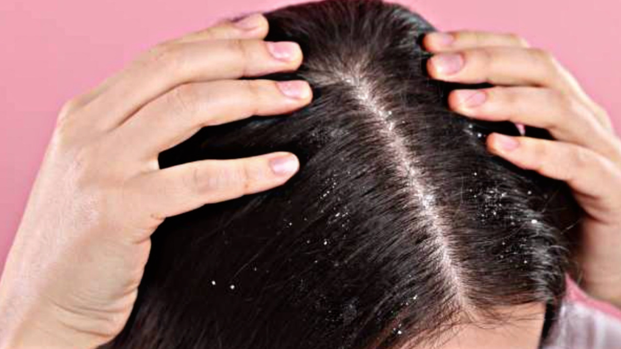 ACE54779 7E3F 466A BCA7 EBEFBBA44E57