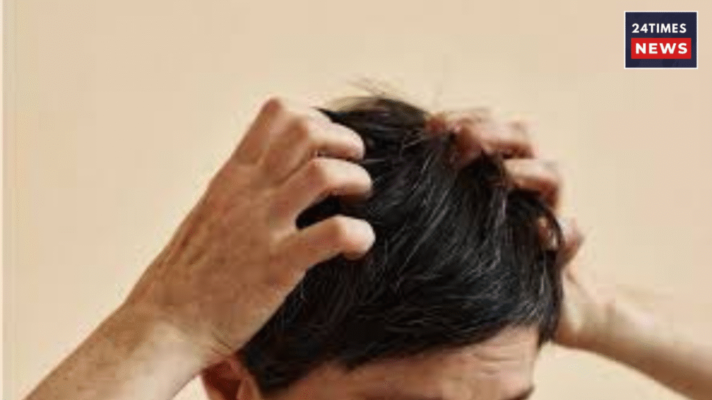 Itchy Scalp
