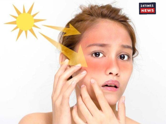 Protecting your skin in harsh sun: Easy ways to avoid summer skin damage.