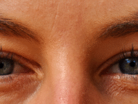 eyes and essential nutrinets