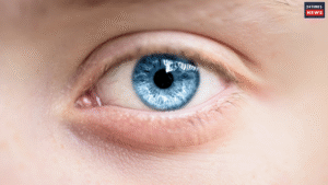 Why Do Your Eyes Water Right After Waking Up? Know the Possible Reasons and Tips to Treat Watery Eyes