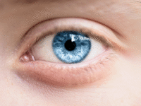 eyes infection 1 3