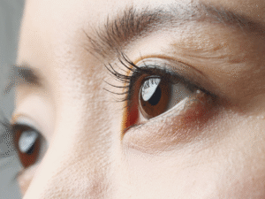 Eyes Start Watering as soon as you wake up. Learn What the possible reasons are how to fix it