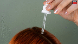 Which Vitamin Deficiency causes hair fall? Know Details Here