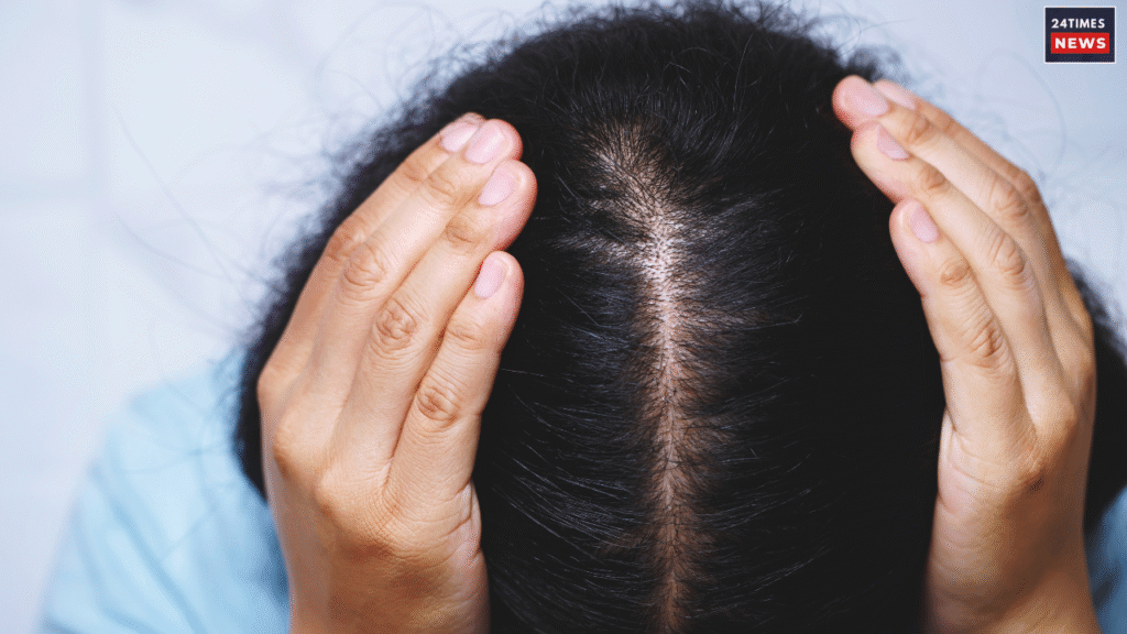 hair fall
