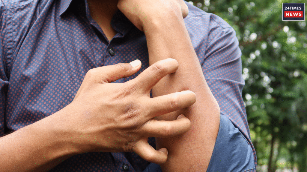 Whole Body Itching All the Time? Know Which Vitamin Deficiency Causes It and What Remedies Can Give Relief