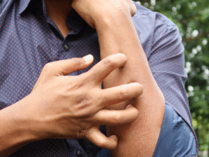 Whole Body Itching All the Time? Know Which Vitamin Deficiency Causes It and What Remedies Can Give Relief