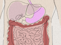 liver damage