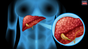 Liver Health: What Causes Liver Damage? Warning Signs You Should Never Ignore