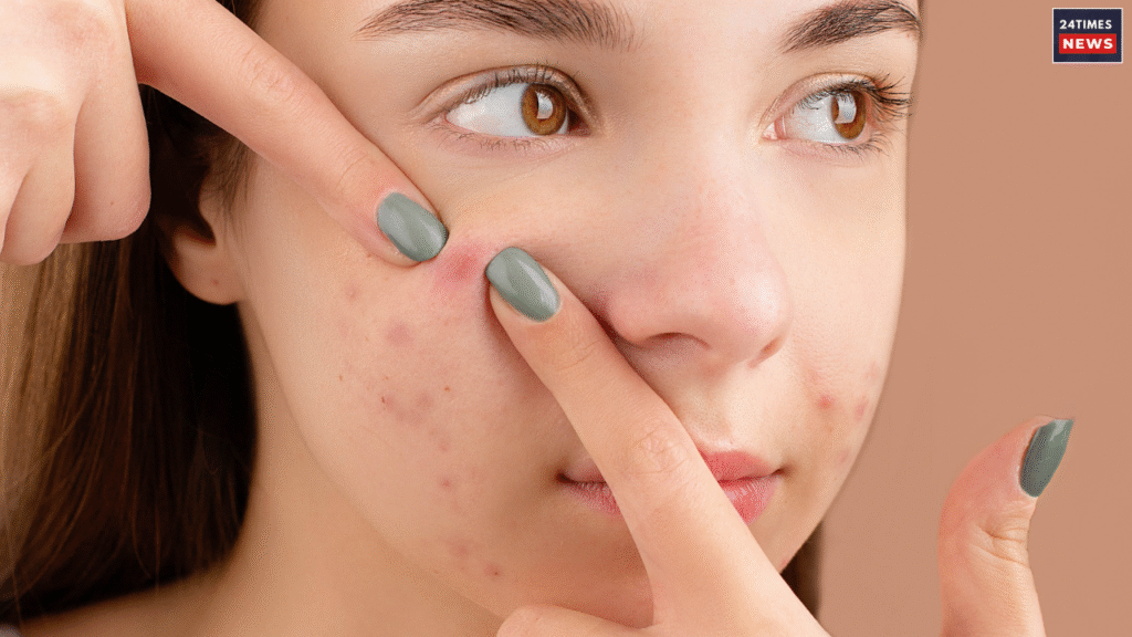 open pores