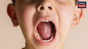 Say goodbye to gum decay in children, adopt these good habits for strong teeth