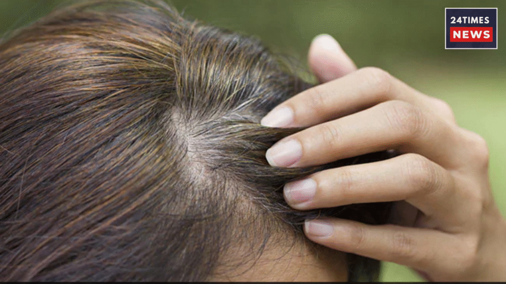Gray hair problem : 5 home remedies to get rid of Gray hair