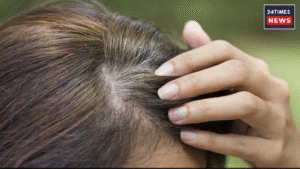 Gray hair problem : 5 home remedies to get rid of Gray hair