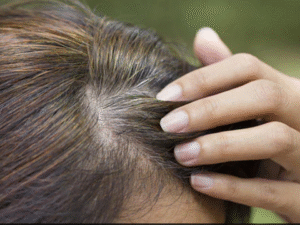 Gray hair problem : 5 home remedies to get rid of Gray hair