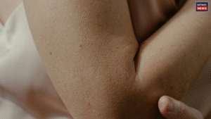 Dark Elbows? Here are the Best Home Remedies to Reduce Dark Elbows Naturally at Home