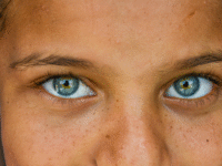 pigmentation 1