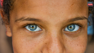 How to Get Rid of Skin Pigmentation? Simple Home Remedies for Clear and Glowing Skin