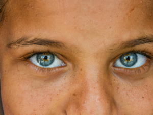 How to Get Rid of Skin Pigmentation? Simple Home Remedies for Clear and Glowing Skin