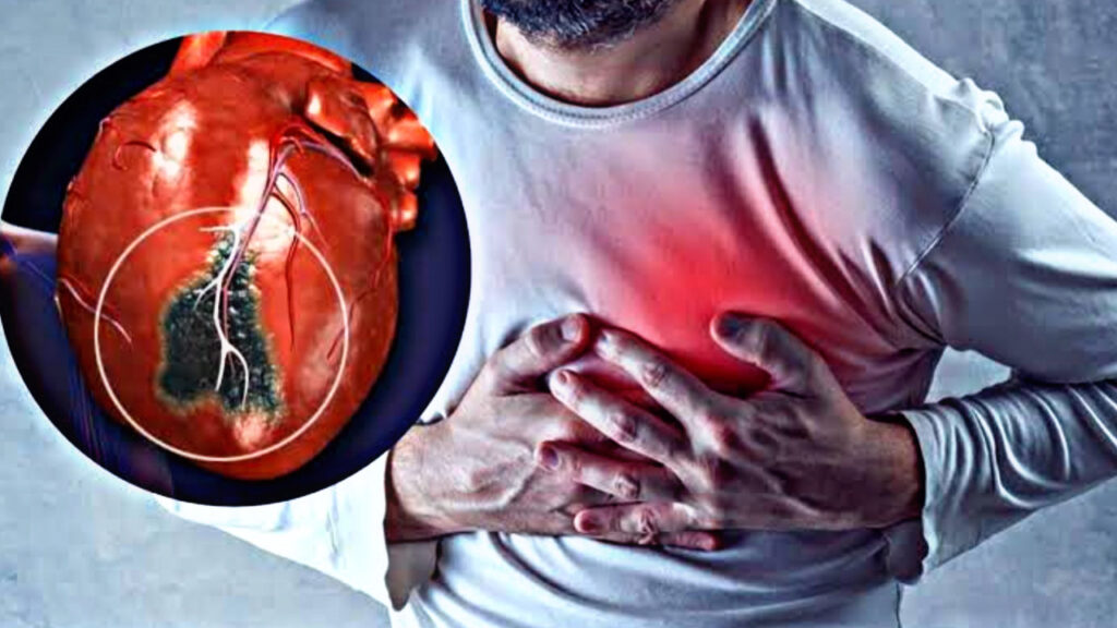 C1D58C10 36B9 4457 A912 890ABD00E309 These are the signs that appear before a heart attack—find out now