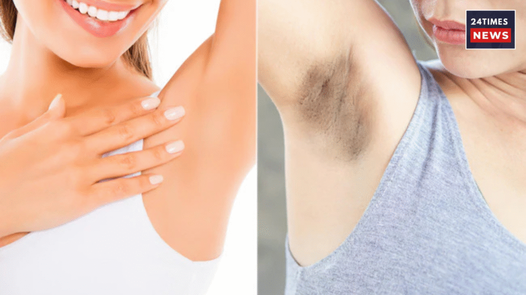5 effective home remedies to remove dark underarms