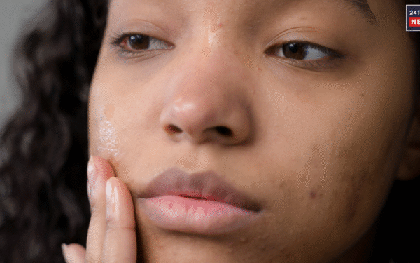 skin problems 3