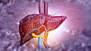Include these drinks in your life to cleanse your liver