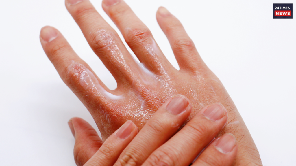 Dry hands? Not anymore. Use these simple tips to get smooth and soft hands