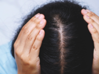 hair health 1