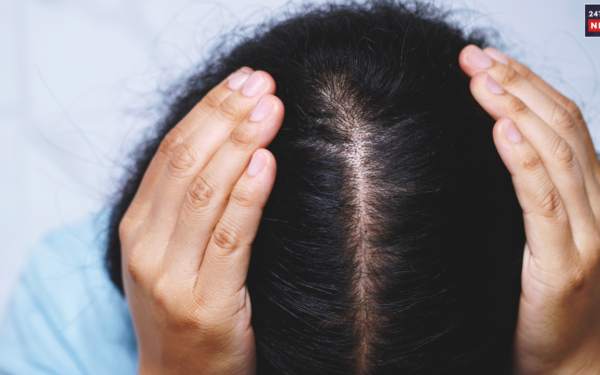 hair health 1