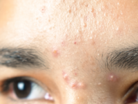 skin problemsss 1