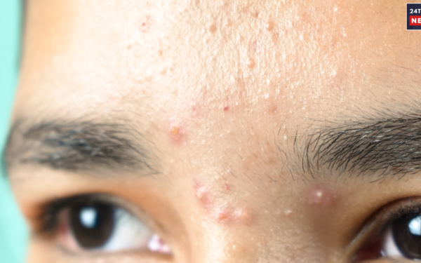skin problemsss 1