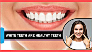 Eat these things to keep your teeth healthy, make your teeth white and healthy like this