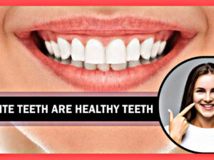 Eat these things to keep your teeth healthy, make your teeth white and healthy like this