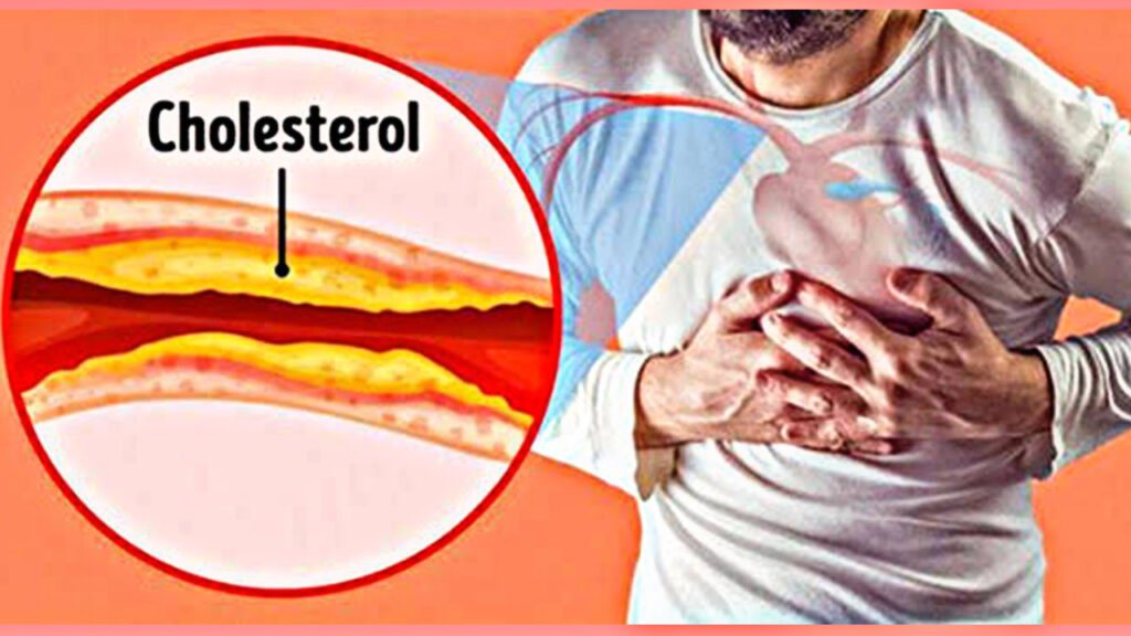 Follow these home remedies to control cholesterol, know in details!