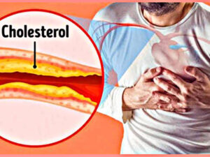 Follow these home remedies to control cholesterol, know in details!