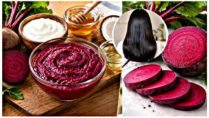 What are the benefits of applying a beetroot hair mask? Learn all about it!